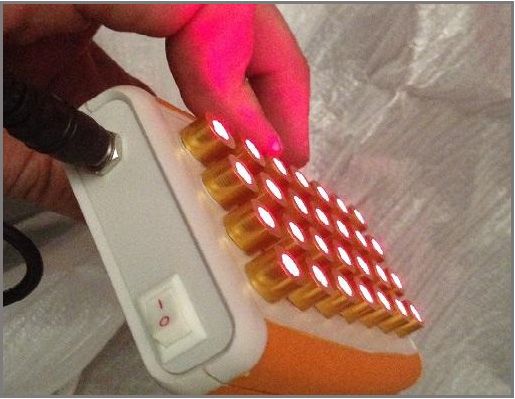 laser